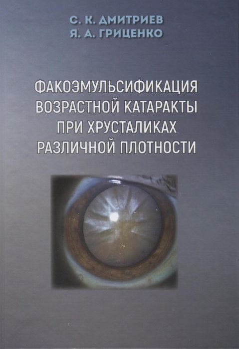 Факоэмульсификация возрастной катаракты при хрусталиках различной плотности